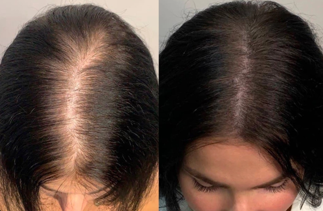 5AFCDBF9-FF6B-4361-9CB6-2C8F7105BE26